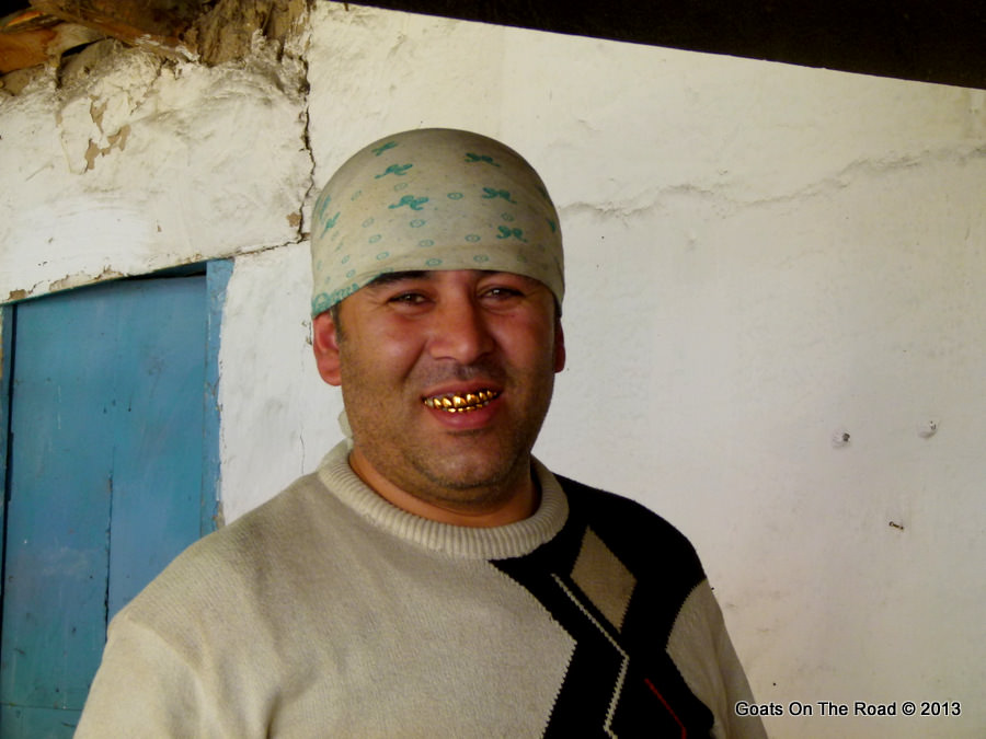 gold teeth kyrgyzstan 